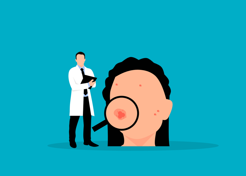 What are the Types of Acne?